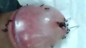 Dude's urethra is being infested by ants and shit